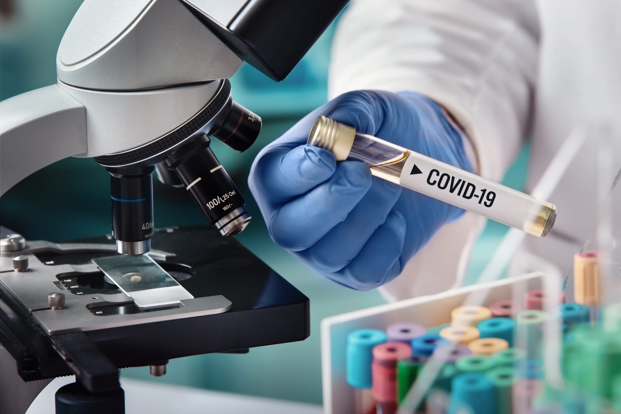 coronavirus test tube